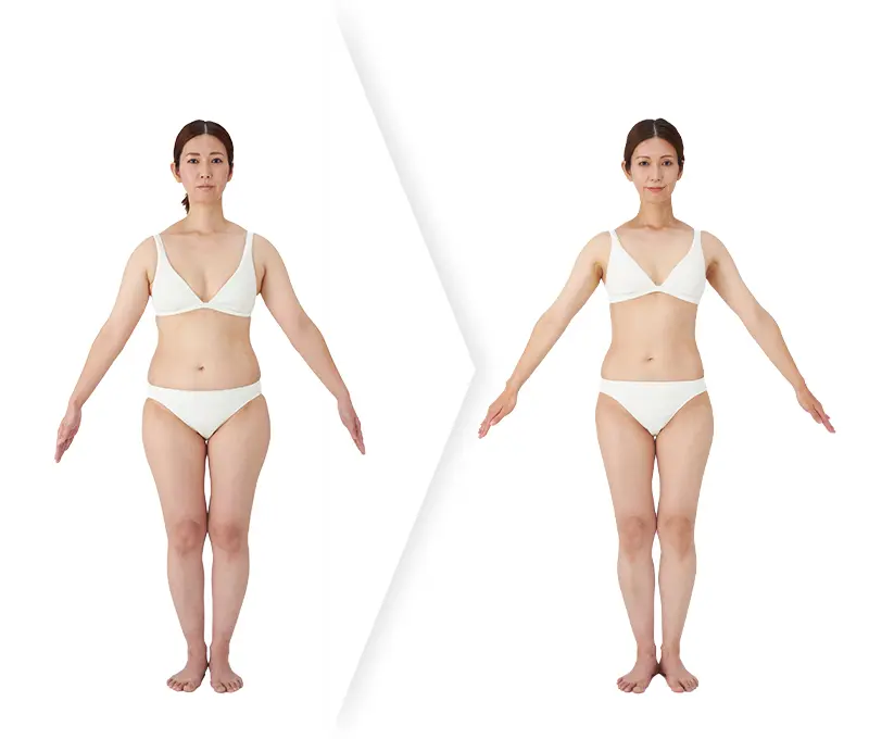 木下さんのビフォーアフター比較