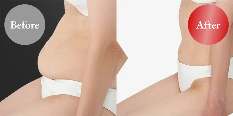 木下さんの証言写真