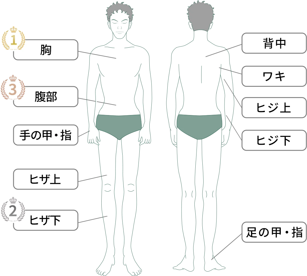 脱毛部位一覧