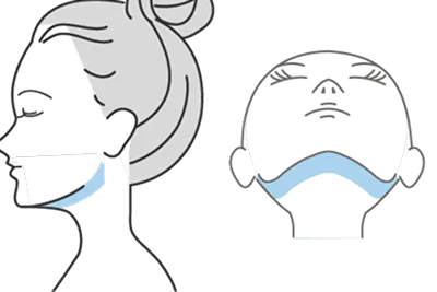 フェイスライン