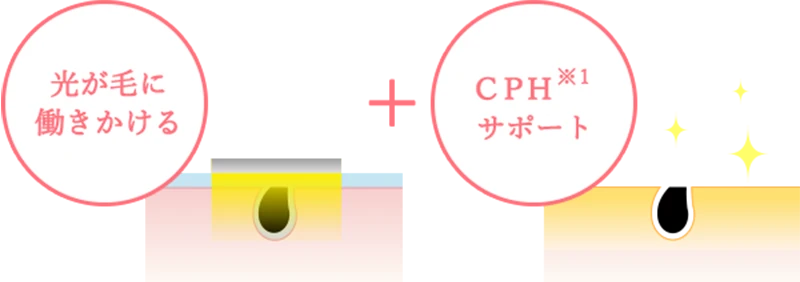 肌に優しい脱毛の説明