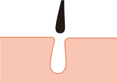 毛の構造図