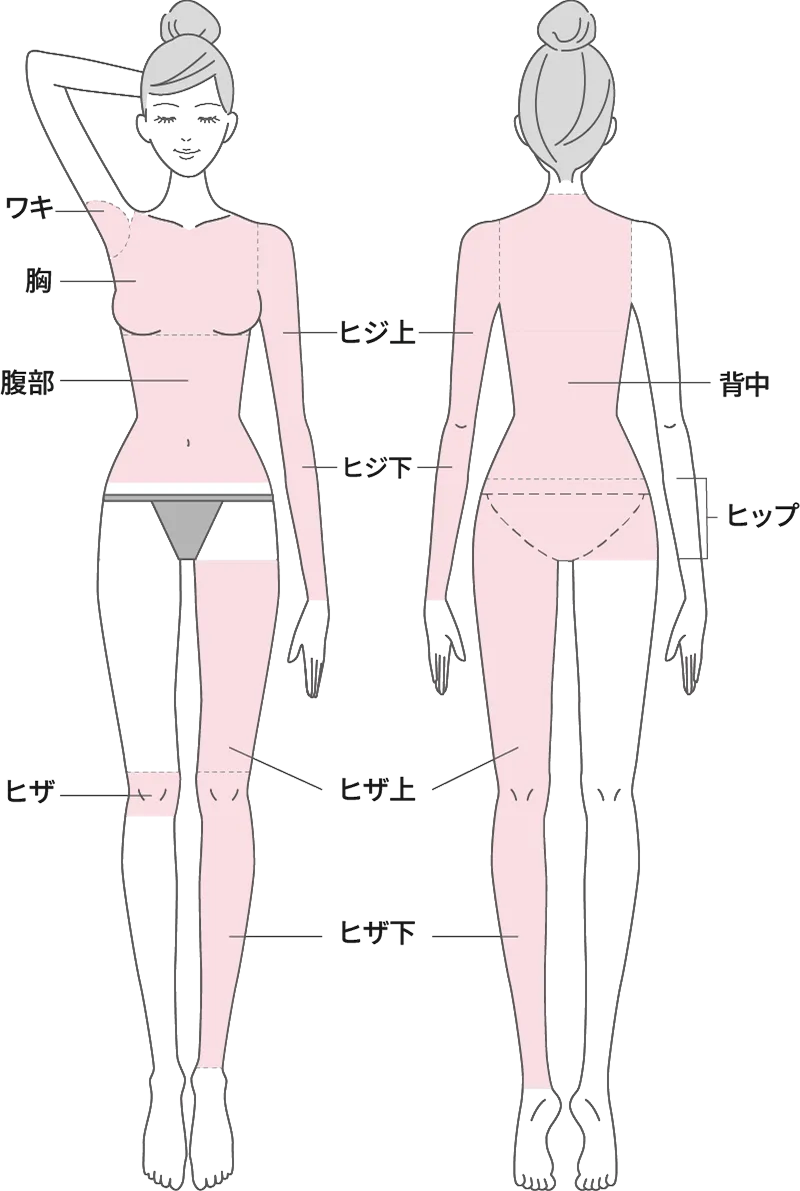 脱毛範囲図