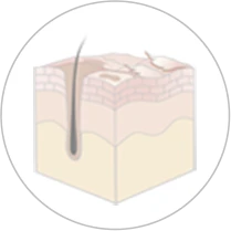 白い粉が吹いている