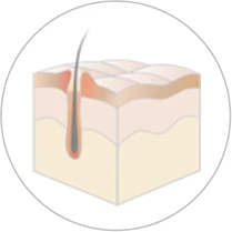 赤み・はれがある