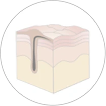 肌の中に毛がうもれている