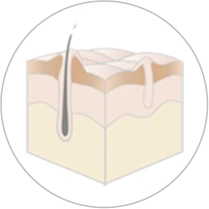 ぶつぶつと肌がもり上がっている