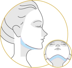 フェイスライン