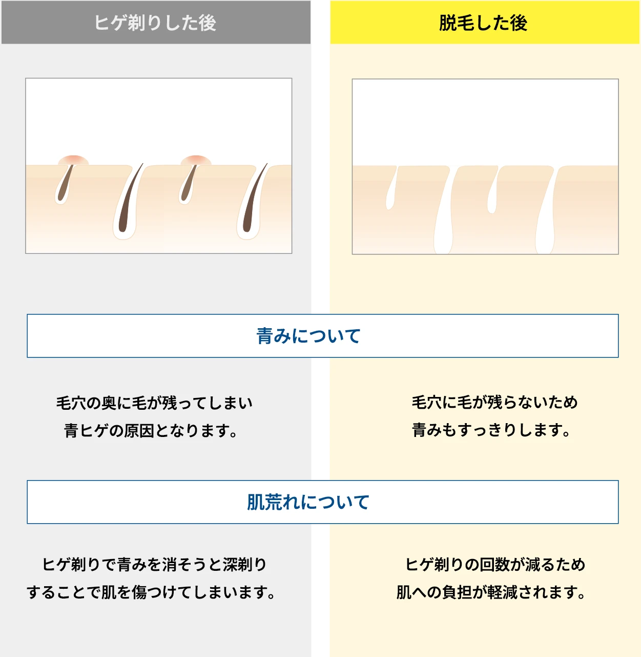 ヒゲ剃りと脱毛後の違い