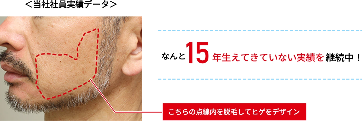 15年生えてきていない実績を継続中