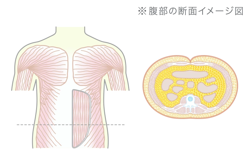 ボディシェイプ開始前の状態