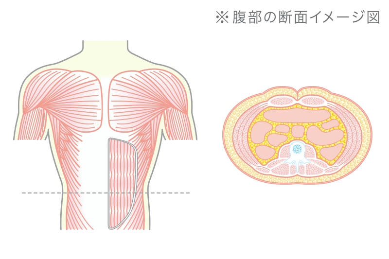 MEN’S TBCのボディシェイプ後