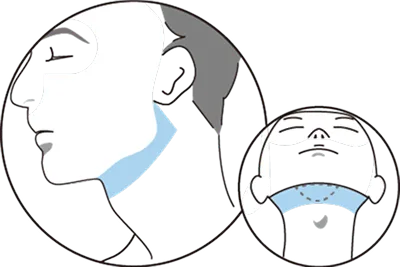 フェイスライン