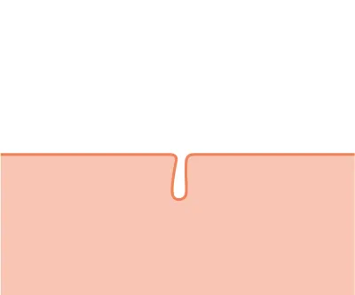 毛穴がひきしまる