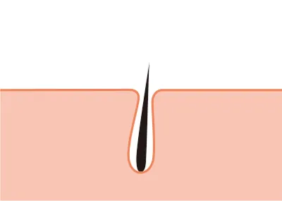しばらくすると毛が細くなる