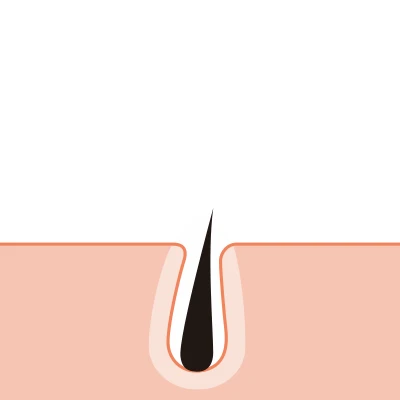 MEN'S TBCスーパー脱毛（美容電気脱毛）｜MEN'S TBC