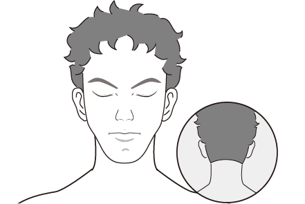 ヒゲ・顔の脱毛イメージ