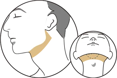 フェイスラインイメージ