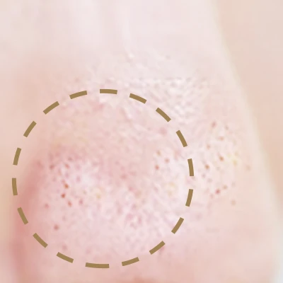 自分で洗顔した肌