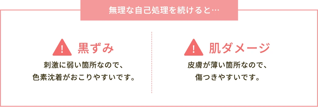 無理な自己処理を続けると黒ずみや、肌ダメージが